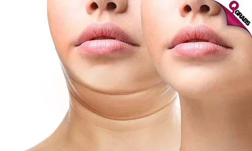 HIFU Skin Tightening Sessions!